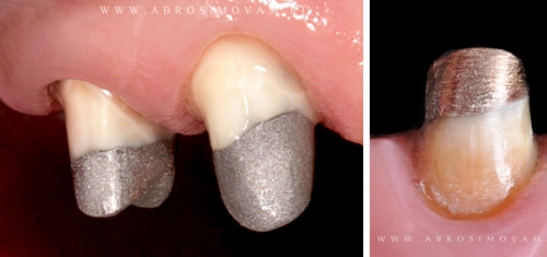 Культевая вкладка