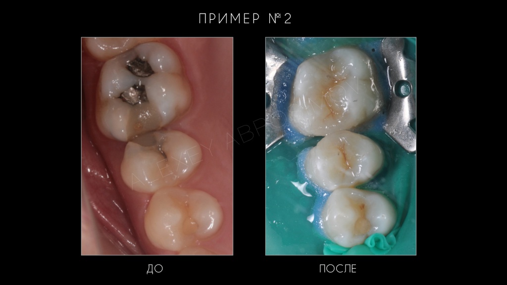 Рефрактор