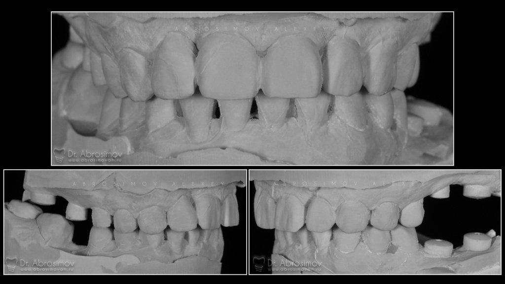 Модель стоматология